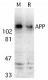 APP / Beta Amyloid Precursor Antibody