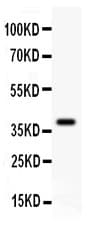 DCN / Decorin Antibody (aa31-359)