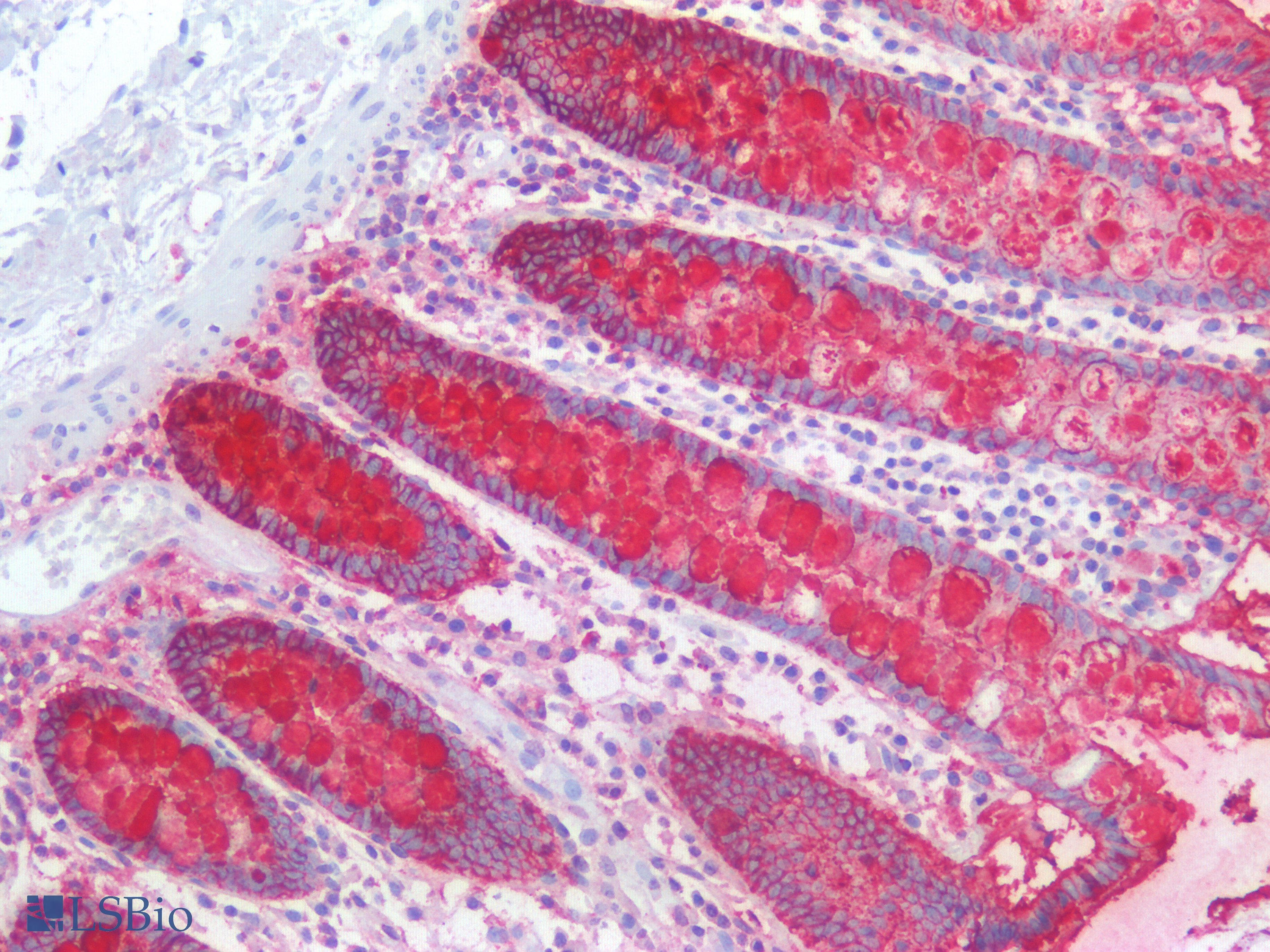 IHC-plus™ Lewis y / BG8 / CD174 Antibody (Concentrated)
