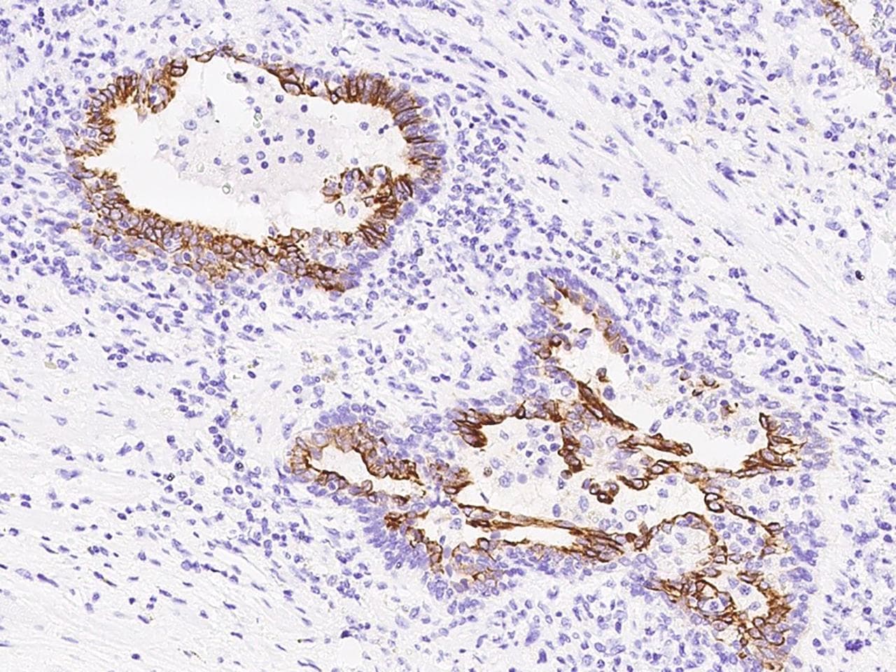 LOXL2 Antibody (Preservative Free)