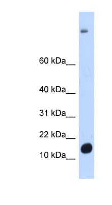 Polyclonal Rabbit anti-Human C6orf201 Antibody (aa395-444, WB)