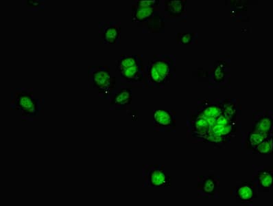PHAP1 / ANP32A Antibody (aa1-170)