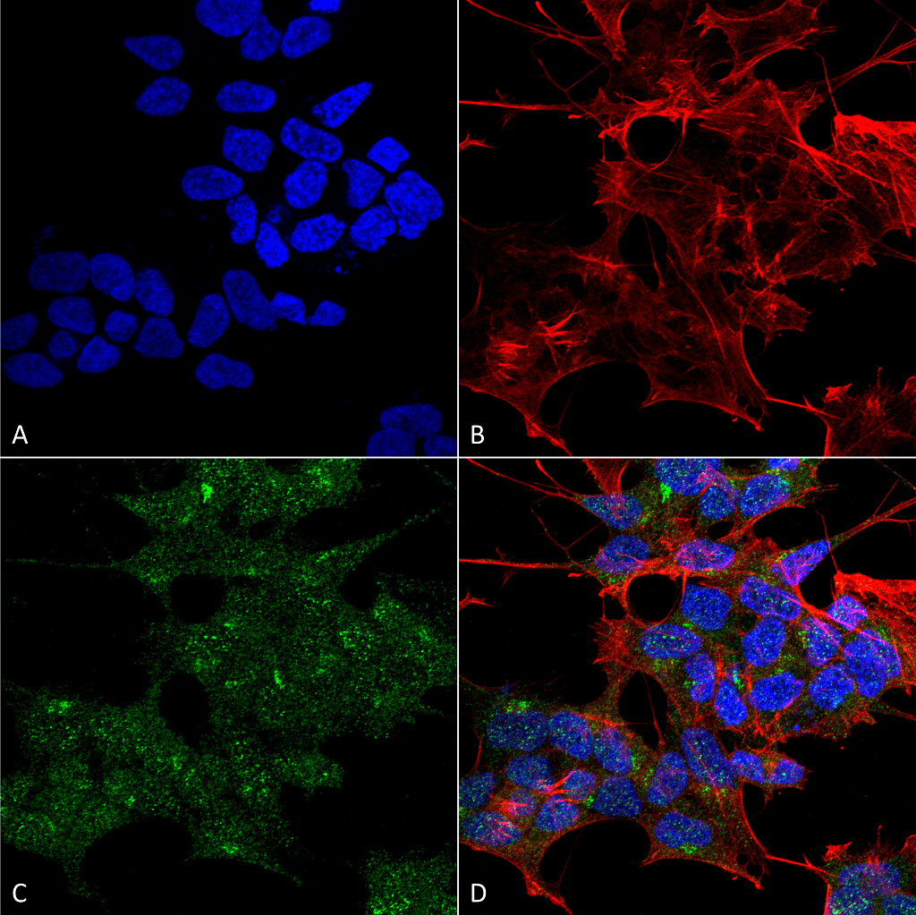 RAB1B Antibody (RPE)
