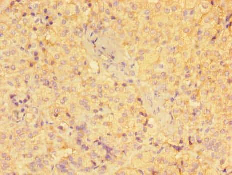 GSTM1 Antibody