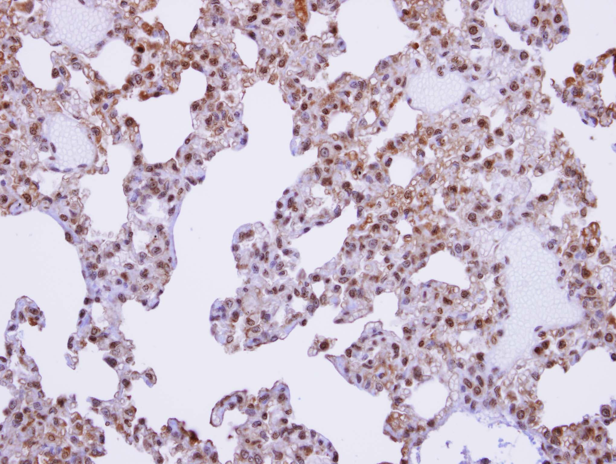 AKAP17A / 721P Antibody (aa473-660)