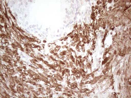 Monoclonal Mouse anti-Human SETD8 / SET8 Antibody (clone OTI3G9, IHC, WB)