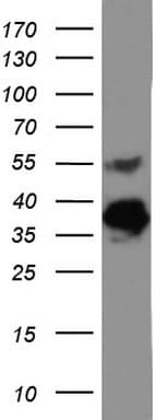 Monoclonal Mouse anti-Human EPCAM Antibody (clone UMAB131, IHC, WB)