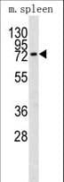MMP9 / Gelatinase B Antibody (aa644-673)