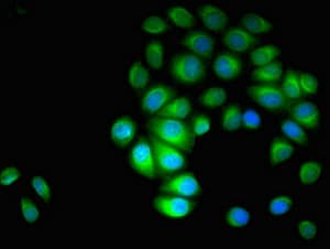 Polyclonal Rabbit anti-Human PARVA Antibody (IHC, IF, WB)