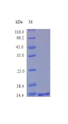 Human SDC4 / Syndecan 4 Protein (Recombinant)