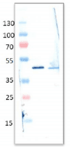 ADA / Adenosine Deaminase Antibody (clone 2C9-1B4)
