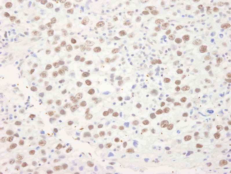 DHX9 Antibody (aa1220-C-term)