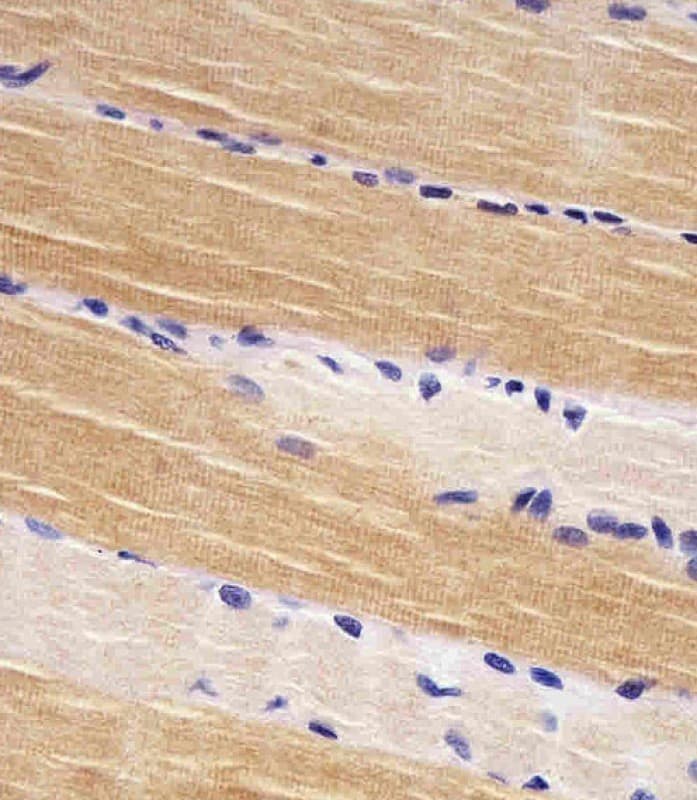 TTN / Titin Antibody (aa7169-7203)