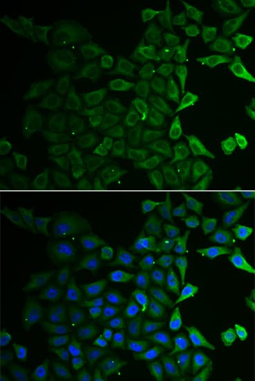 Polyclonal Rabbit anti-Human GT335 / ES1 Antibody (IHC, IF, WB)