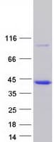 Human TPM4 Protein (Recombinant Myc-DDK (Flag))