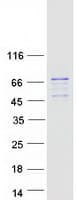 Human USP21 Protein (Recombinant Myc-DDK (Flag))