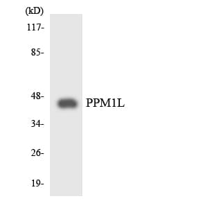 PPM1L Antibody (aa102-151)