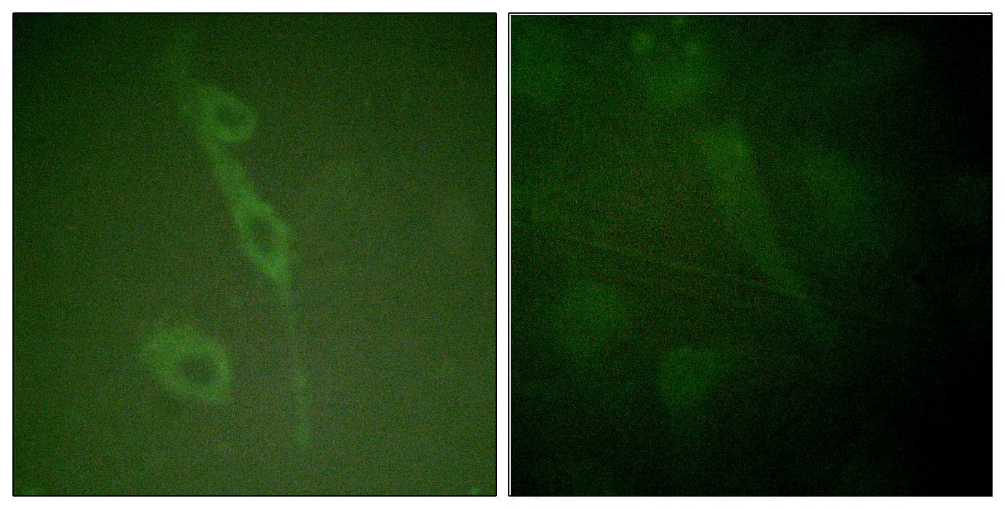 IL7R / CD127 Antibody (phospho-Tyr449)