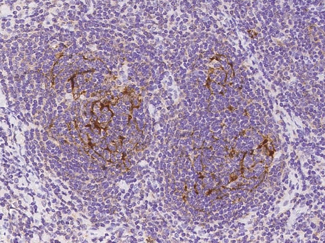 SAMSN1 Antibody