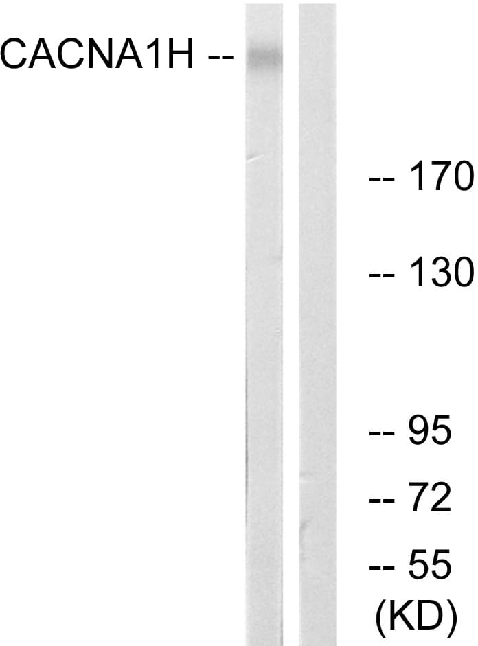 CACNA1H / Cav3.2 Antibody (aa462-511)