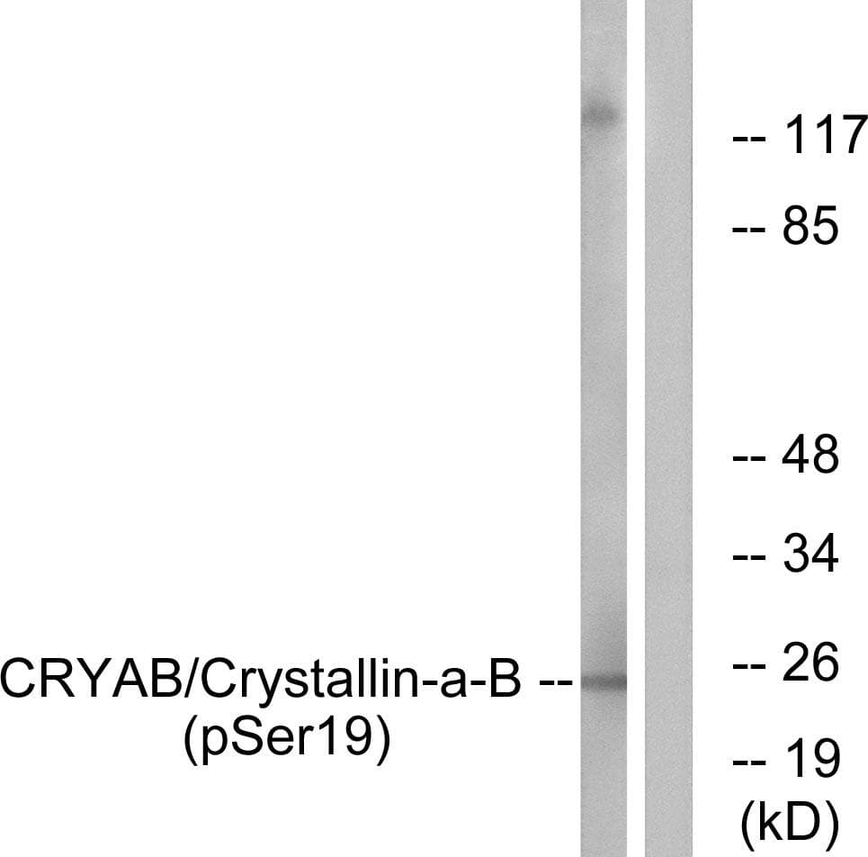 Polyclonal Rabbit anti-Human CRYAB / Alpha B Crystallin Antibody (phospho-Ser19, IHC, WB)