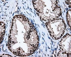 HMRF1L / MTRF1L Antibody (clone OTI1E3)