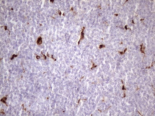 Monoclonal Mouse anti-Human NR2C2 / TAK1 Antibody (clone OTI1E1, aa1-241, IHC, WB)