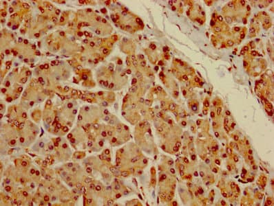 Polyclonal Rabbit anti-Human DYRK3 Antibody