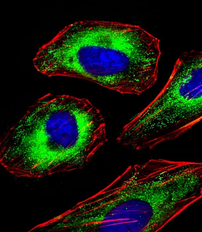 Polyclonal Rabbit anti-Human FOXO4 / AFX1 Antibody (aa206-240, IF, WB)