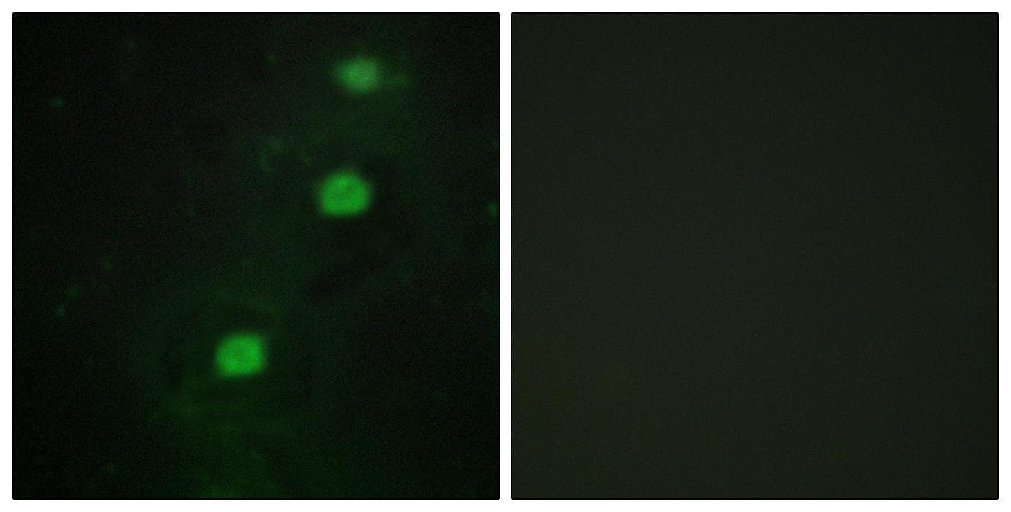 CDK20 / CCRK Antibody