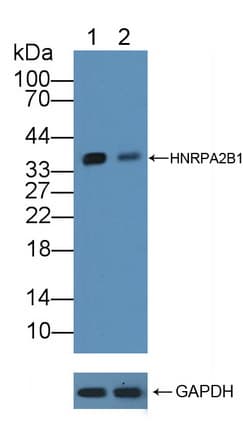 Polyclonal Rabbit anti-Human HNRNPA2B1 Antibody (aa21-103, WB)