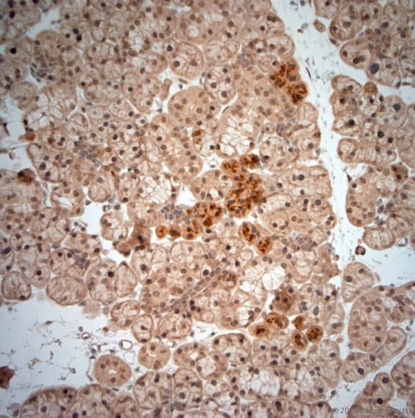 NGF Antibody (aa195-240)