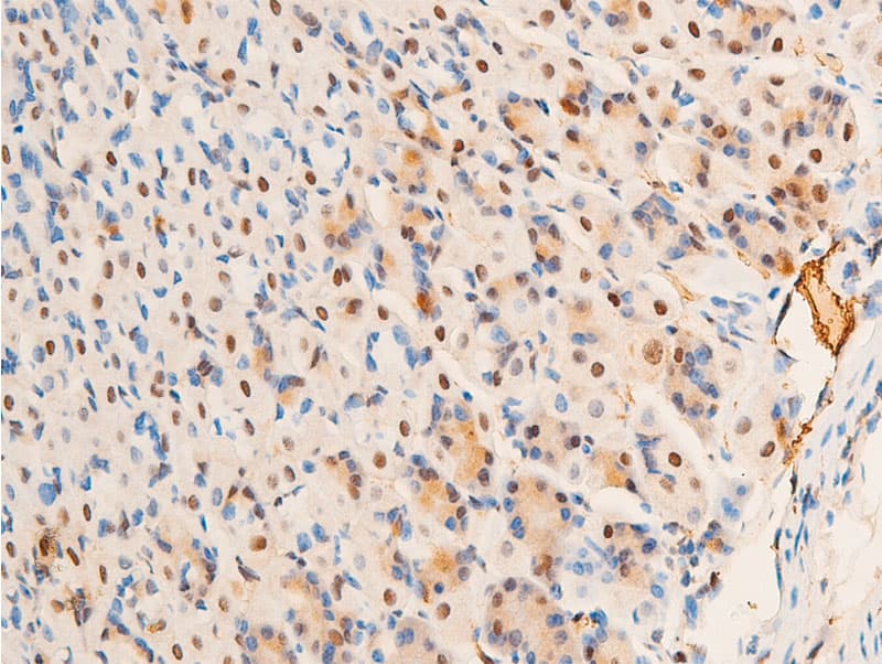 JUN / c-Jun Antibody (phospho-Thr93)