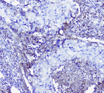 Lumican Antibody