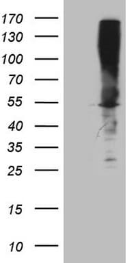 ASS1 / ASS Antibody (C-Terminus, clone OTI4G9)