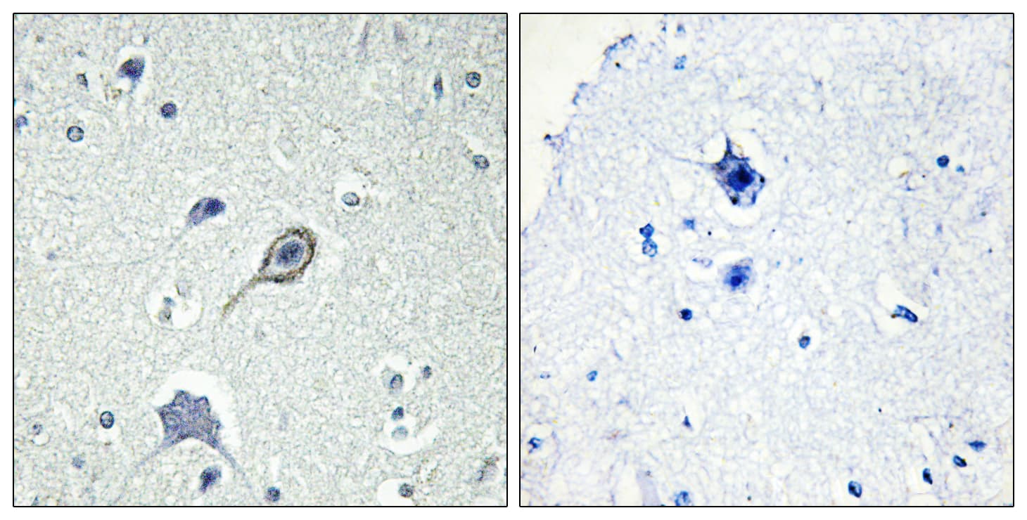 Polyclonal Rabbit anti-Human CNR1 / CB1 Antibody (aa151-200, IHC, IF, WB)