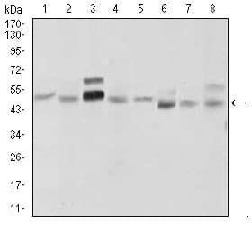 Monoclonal Mouse anti-Human SHH / Sonic Hedgehog Antibody (clone 5H4, IHC, WB)
