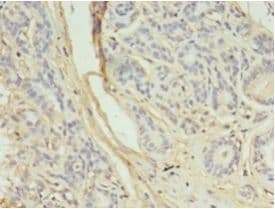AURKB / Aurora-B Antibody