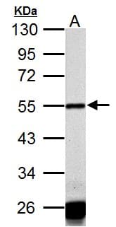 CASQ1 / Calsequestrin 1 Antibody