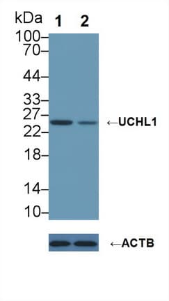 Polyclonal Rabbit anti-Rat UCHL1 / PGP9.5 Antibody (aa2-223, WB)