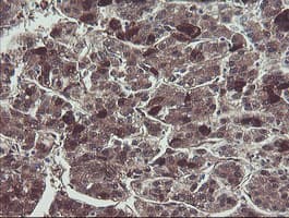 TSC22D1 / TSC22 Antibody (clone OTI1A5)