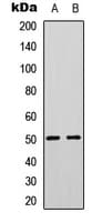 PTP1B Antibody (N-Terminus)