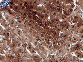 QPRT Antibody (clone OTI7A8)