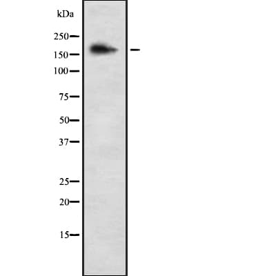 Polyclonal Rabbit anti-Human COL5A3 / Collagen V Alpha 3 Antibody (WB)