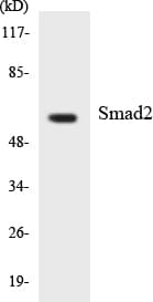 SMAD2 Antibody (aa202-251)