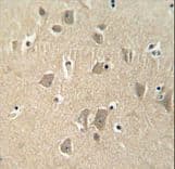 FAM190A Antibody (aa780-808)