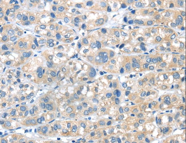 PLXNA2 / Plexin A2 Antibody