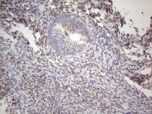 IRS1 Antibody (aa1-280, clone OTI2B10)