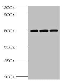 DCP2 Antibody (aa1-240)