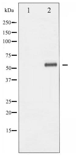 Polyclonal Rabbit anti-Human ELK1 Antibody (phospho-Ser389, IHC, WB)